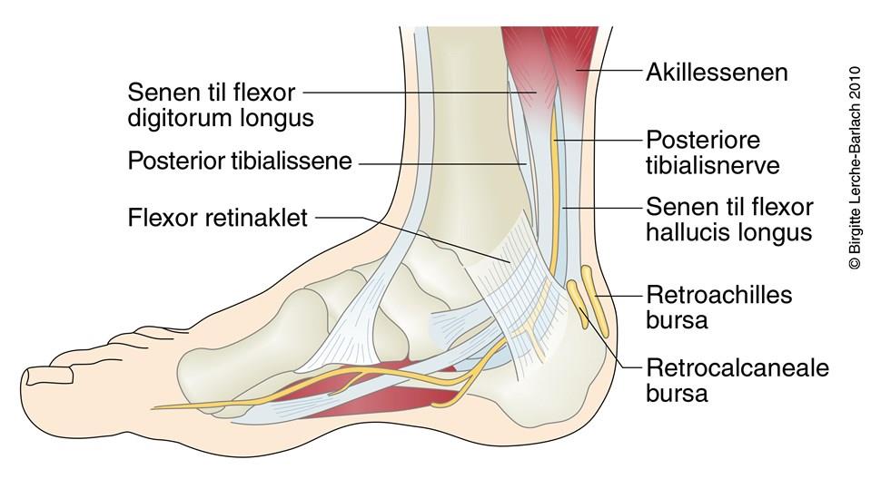 Nerveindklemning i fod (tarsaltunnelsyndrom) - Fodkirurgi, ankelkirurgi, nedgroet hammertå -